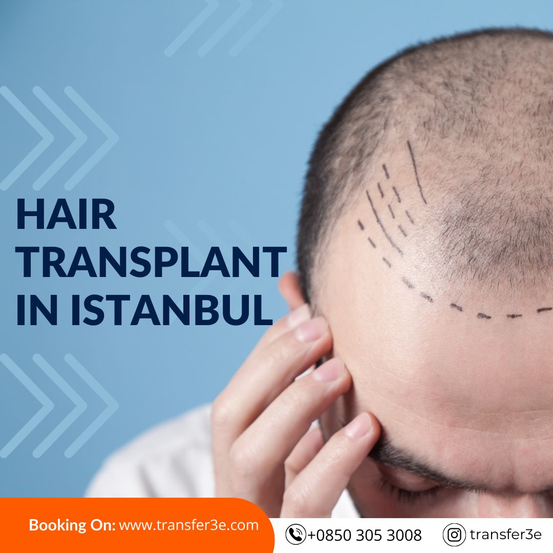 Transform Your Look: The Ultimate Guide to Hair Transplant in Istanbul